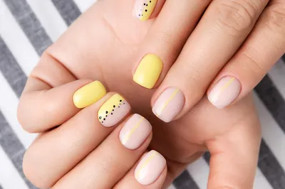 Лечение ногтей СПб. Лечение болезней ногтей в Nail Clinic