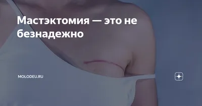 Мастэктомия ᐈ Удаление груди в Киеве — Цена в «Mediland»