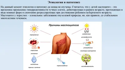 По какой причине может появится мастоцитоз