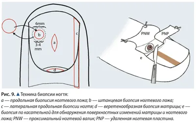 Строение ногтей - Pnbshop