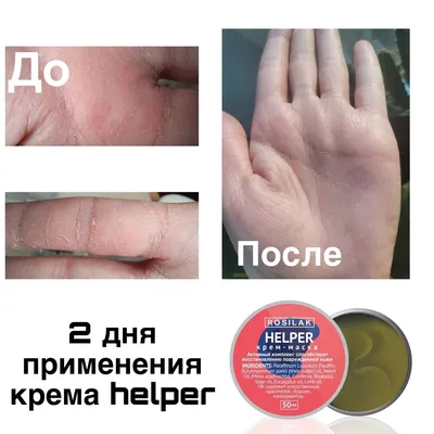 Лечебный педикюр