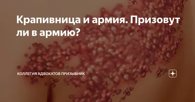 ПрофЭпил - Что это такое❓ Дермографическая (механическая)... | Facebook