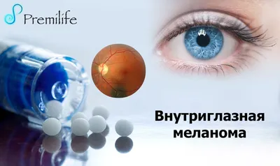 Меланома глаза – симптомы, диагностика, лечение меланомы сетчатки глаза,  кожи века и радужной оболочки