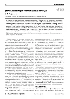 Увеальная меланома (меланома хориоидеи) – Лечение в Киеве