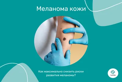 Меланома: во что могут превратиться обычные родинки, причины возникновения  меланомы, факторы риска, виды меланомы, стадии развития, симптомы  заболевания, диагностика, лечение, профилактика