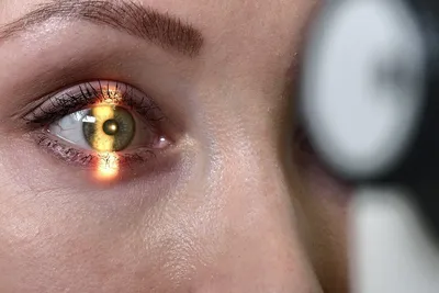 Угроза жизни: эти три цвета глаз имеют повышенный риск развития рака —  проверьтесь сейчас | MARIECLAIRE