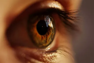Лечение меланом глаза в Израиле - IsraHospital