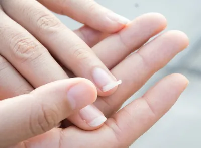 Лунулы на ногтях: что означают и почему исчезают?