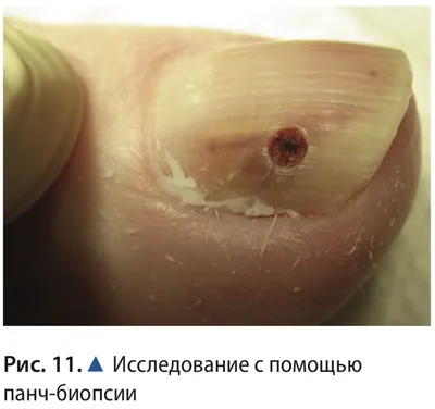 Хирург рассказал об опасности появления темной полосы на ногте: Явления:  Ценности: Lenta.ru