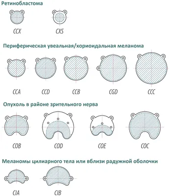 Офтальмолог Ивановская Наталья Алексеевна - Почему желтеет склера глаза,  какие причины вызывают это явление ?! ⠀ Если обнаружены желтые склеры глаз,  причины такого явления могут быть разными. Чаще всего они свидетельствуют о