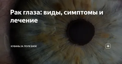 Implantation and Evaluation of Melanoma in the Murine Choroid via Optical  Coherence Tomography | Protocol (Translated to Russian)