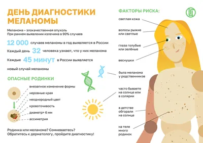 Меланома кожи: стадии, фото и процедура лечения. Онкология