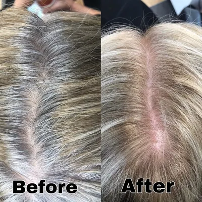 Прикорневое мелирование на отросшие корни волос: фото, техника выполнения