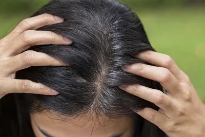 Седые волосы: как избавиться от седины женщинам, мужчинам без окрашивания в  домашних условиях, причины появления, советы трихологов