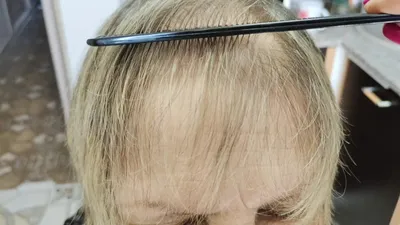 Мелирование на тонкие волосы фото фото