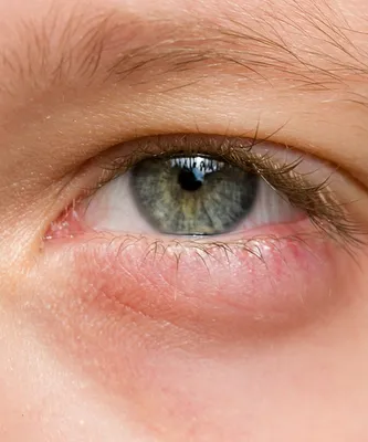 Новинка от отёков НАД и ПОД ГЛАЗАМИ / StriVectin Hyperlift Eye Instant Eye  Fix https://youtu.be/RL4CBnCHj6I #strivectin #eye… | Instagram