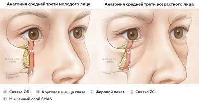 Как избавиться от мешков под глазами и нависших век Major Beauty