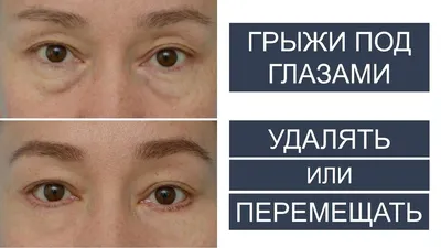 Крем для кожи вокруг глаз EELHOE ретинол, укрепляющий и разбавляющий кожу  вокруг глаз, увлажняющий, улучшает темные круги, мешки для глаз, крем  против морщин | AliExpress
