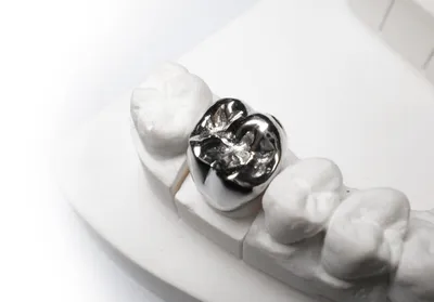 Коронка на зуб | цена на зубные коронки в Ростове-на-Дону в стоматологии  Чернявского