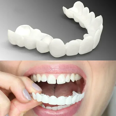 Циркониевые коронки – отличный вариант для протезирования зубов | Частная  практика Ирины Зайцевой