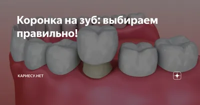 Металлокерамика коронка на зуб цена плюсы и минусы