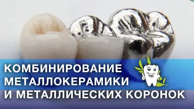 Керамические коронки на зубы — описание видов с фото, цены, плюсы и минусы