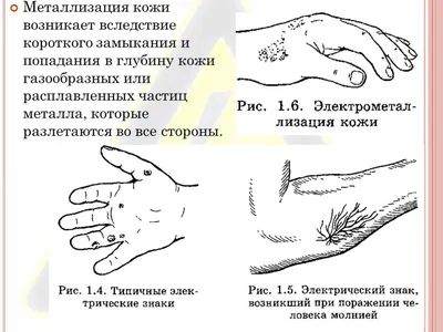 Действие электрического тока на организм человека. Виды поражений и факторы,