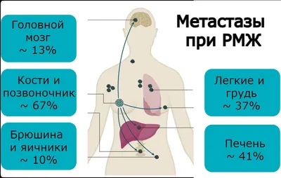 Рак кожи: плоскоклеточный, базальноклеточный, меланома - диагностика и  лечение в Москве