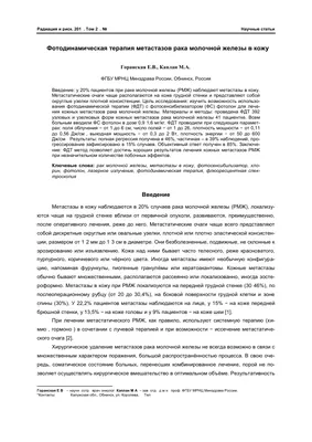 Рак кожи: симптомы, как выглядит, признаки, стадии, лечение