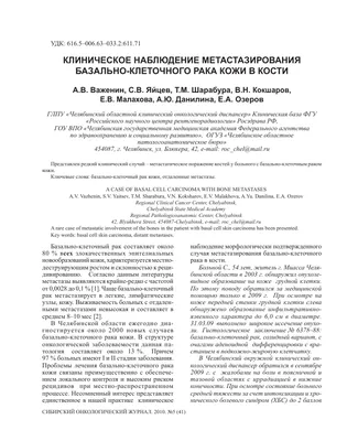 Опыт лечения плоскоклеточного рака кожи у пациентов с дистрофической формой  буллезного эпидермолиза uMEDp