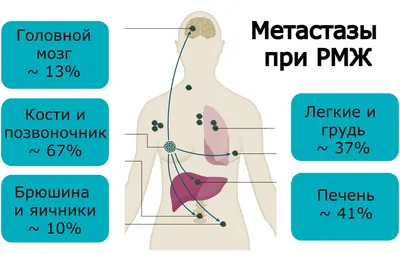 Врач Миргородская рассказала, как по глазам выявить рак, диабет и ещё 10  недугов