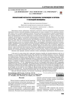 Метастазы в печени | Лечение на разных стадиях | Клиника НАКФФ в Москве