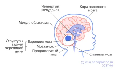 В мозге онкобольной Шеннен Доэрти нашли метастазы: ужасные кадры. Читайте  на UKR.NET
