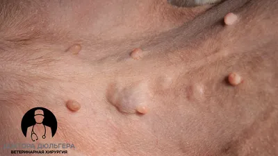 Метастазы в кожу злокачественных опухолей внутренних органов: три кл