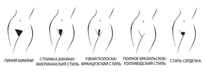 Лазерная эпиляция бикини для мужчин в Санкт-Петербурге - Клиника \"Отражение\"