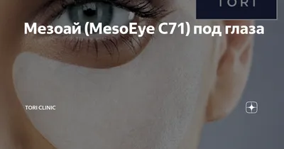 Коррекция кожи глаз препаратом МезоАй ( MesoEye) - ЦИДК