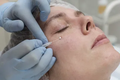 Синяки под глазами: эффективные способы коррекции | Мезотерапия и  косметология в клинике Vitaura