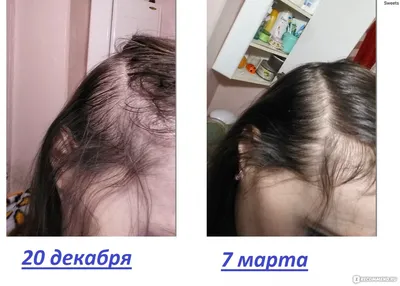 Мезотерапия для волос в Москве — 1758 специалистов, 80 отзывов на Профи