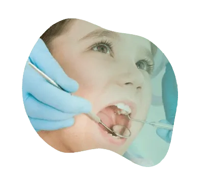 Лейкоплакия полости рта и языка: фото, симптомы и лечение