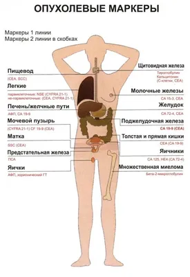 Меланома - причины появления, симптомы заболевания, диагностика и способы  лечения