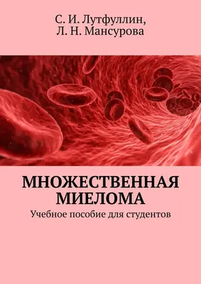 Множественная миелома: как заподозрить и лечить