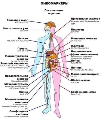 Иллюстрация 14 из 15 для Множественная миелома и плазмоклеточные  заболевания - Рамасами, Лониал | Лабиринт - книги. Источник: