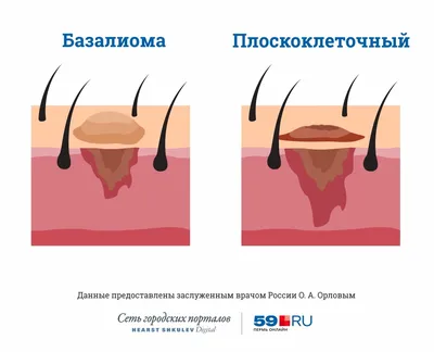 Все об УЗИ и здоровье доктор Загородняя НВ | Не так страшен черт, как его  малюют 😉 И здесь речь о миоме матке. Стоит её бояться? Что это такое?  Ставь ❤️ и