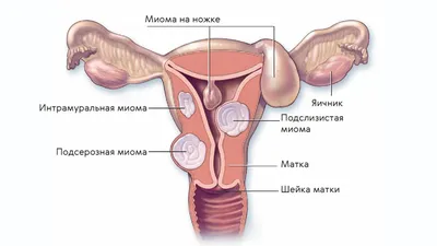 Как отличить рака кожи от меланомы — фото с примерами и рекомендации  онколога - 14 февраля 2019 - 59.ru