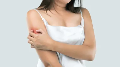 Лечение микоза и грибковых заболеваний кожи | ESTET-PORTAL | Дзен