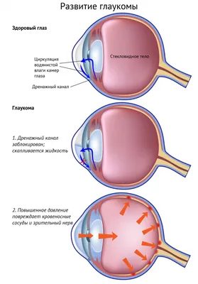 Врач-офтальмолог Н.И. Давлетшина выступила на международном  офтальмологическом конгрессе «Белые Ночи» - РКОБ им. проф. Е.В. Адамюка