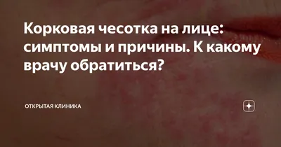 Крем для лица и тела Эмолиум специальный - «Отзыв человека с истинной  экземой. Эмолиум предназначен для УХОДА за сухой кожей, склонной к  дерматитам, экземе, псориазу. Не обольщайтесь: вылечить заболевание он не  сможет!!!