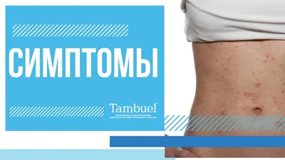 Лечение дерматита в Киеве — Derma.ua