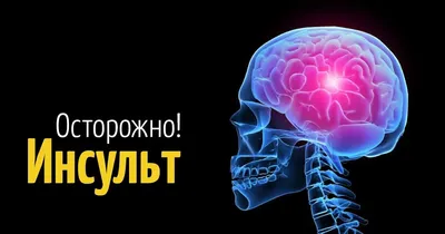 Инсульт: симптомы и первые признаки, как распознать и оказать первую помощь  при инсульте