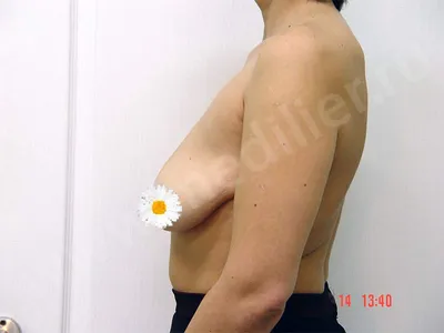 Маммолог Тамаева объяснила, когда маленькая грудь у женщины — это болезнь |  Доктор Питер | Дзен